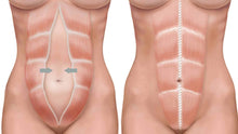 Charger l'image dans la galerie, Ceinture renforcer l'abdomen post-partum avec trois séries حزام مشد الولادة - مشد النفاس التلاثي